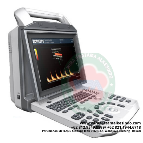 Alat USG color doppler